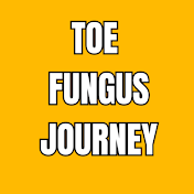 Toe Fungus Journey