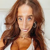 Lizzie Velasquez