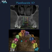 Diagnóstico 3D en ortodoncia