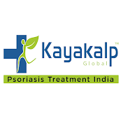 Psoriasis Treatment India By Kayakalp Global