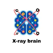 X-ray brain (Degree Study)