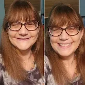 Life With Dentures Told by Tracy Jane