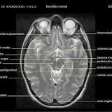 Postgrado Radiología UNAH