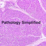 Pathology Simplified