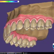 EXOCAD DENTAL DESİNGER