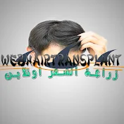 webhairtransplant زراعة الشعر اونلاين