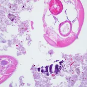 PathologyNOW