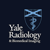 Yale Radiology and Biomedical Imaging