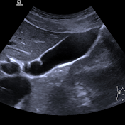 AG Sonographie Charité