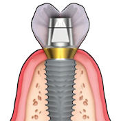 Dr VK's Dental Skool