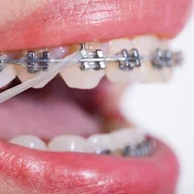 clinical orthodontics
