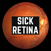 Sick Retina