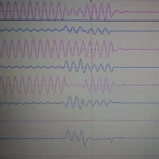 EDDY CURRENT