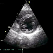 Echocardiographer. org