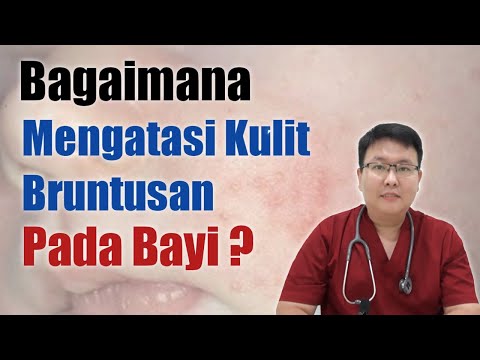 MENGATASI KULIT BRUNTUSAN BAYI - ENSIKLOPEDIA DOKTER