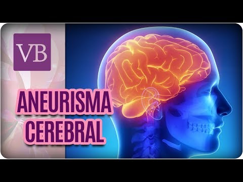 Aneurisma Cerebral: Como Identificar e Tratar - Você Bonita (01/03/185)