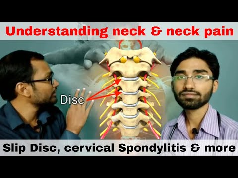 GARDAN AUR GARDAN DARD KO SAMJHE- slip disc, cervical spondylitis, & more!! Dr Sawan & Dr Baisakh