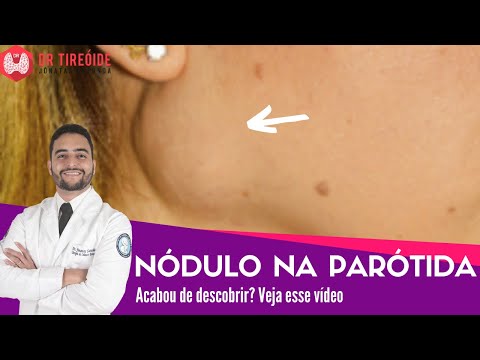 Nódulo na parótida - Vídeo para quem acabou de descobrir! | Dr Jônatas Catunda