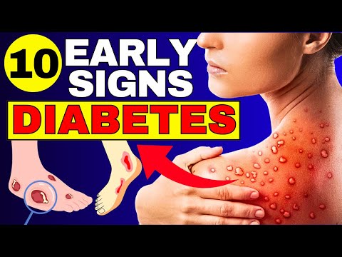 "10 Diabetes Symptoms: Are You Showing These Warning Signs?"