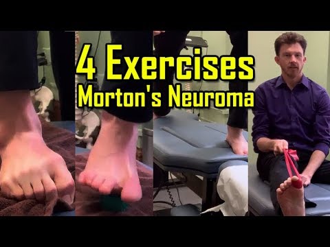 Exercises to AVOID Surgery | How To Heal Mortons Neuroma Quickly