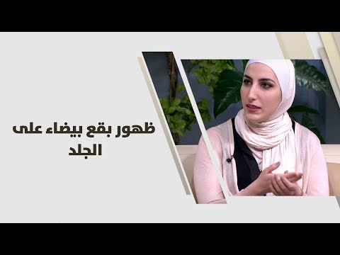 د.عنود العيسى - ظهور بقع بيضاء على الجلد  - طب وصحة