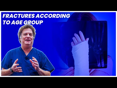 Fractures According to Age Group | Kaplan Surgery