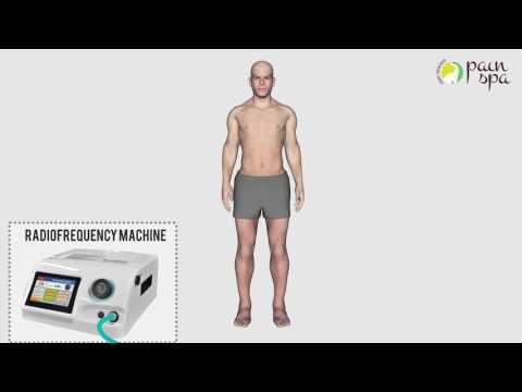 Cooled Radiofrequency of the Knee Joint: COOLIEF