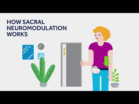 What is Sacral Neuromodulation (SNM)?