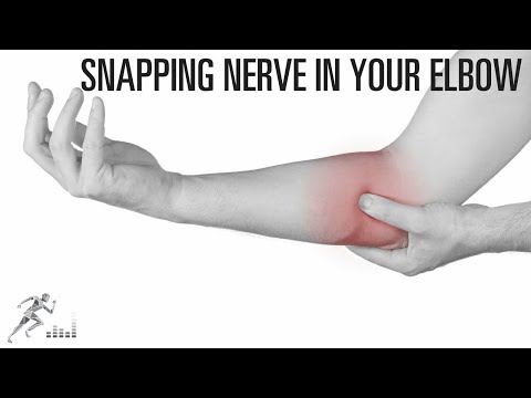 Snapping nerve in the elbow